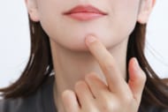 繰り返す顎ニキビの原因は？ホルモンバランスと美容鍼で内側からケア！